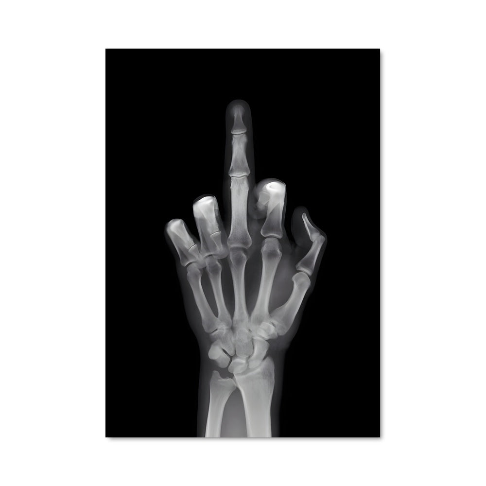 Poster Fracture de l'Attitude