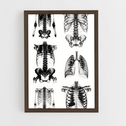 ap-x-rays-3 cadre Bois foncé